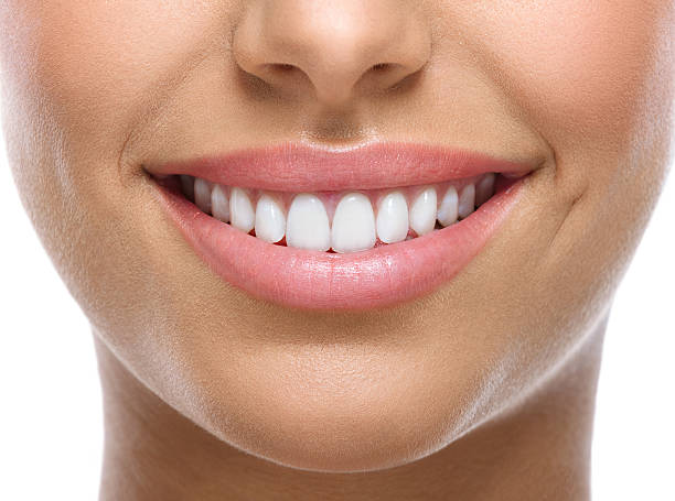 Dentes brancos