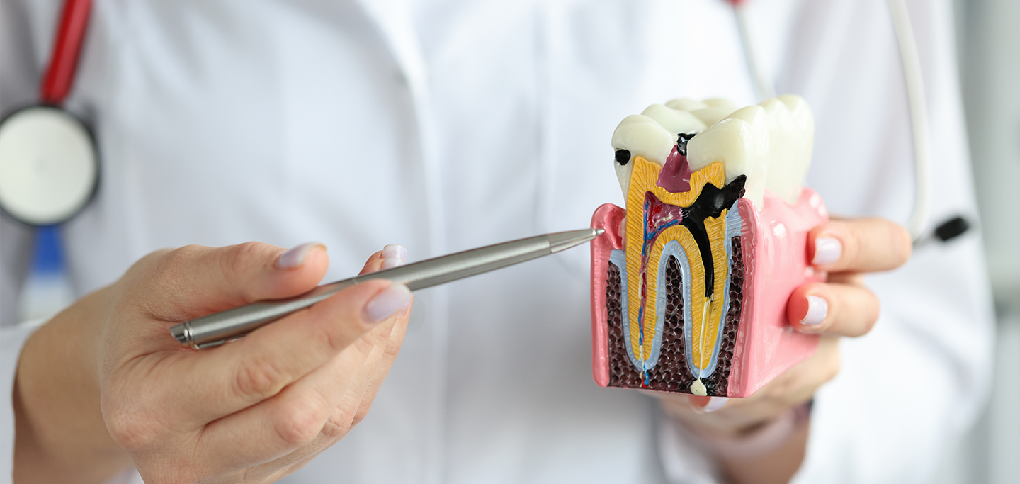Dentista apontando uma cárie